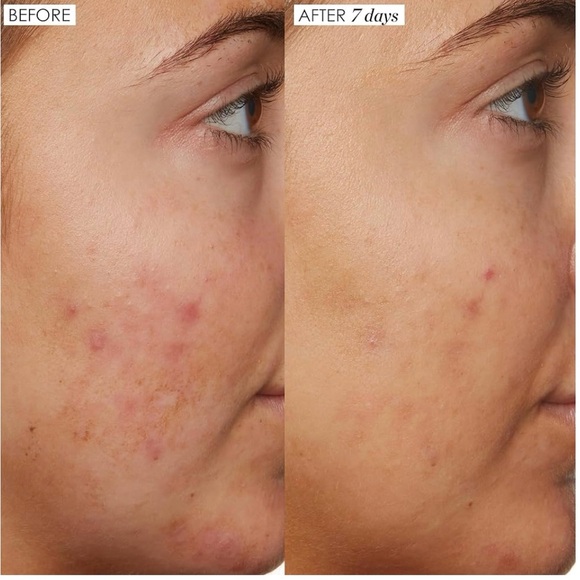 Sunday Riley B Nice - Picture 4 of 8